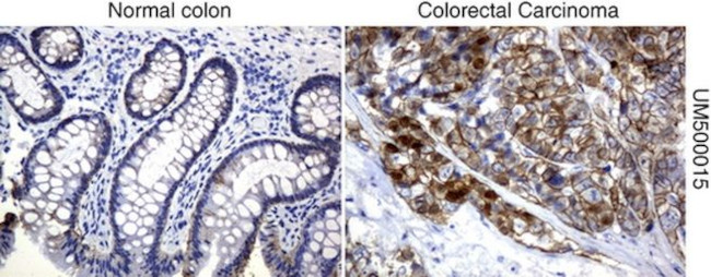 Beta-catenin Antibody in Immunohistochemistry (Paraffin) (IHC (P))