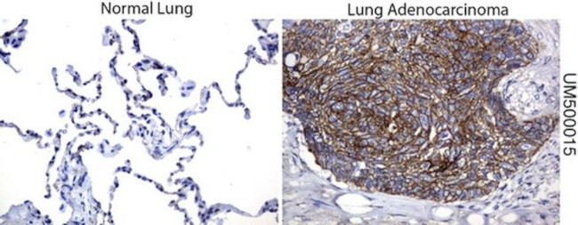 Beta-catenin Antibody in Immunohistochemistry (Paraffin) (IHC (P))