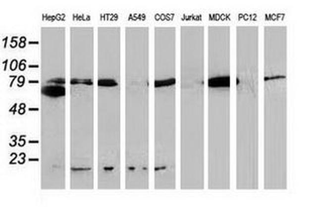 Beta-catenin Antibody in Western Blot (WB)