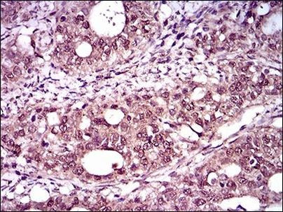 Brachyury Antibody in Immunohistochemistry (Paraffin) (IHC (P))