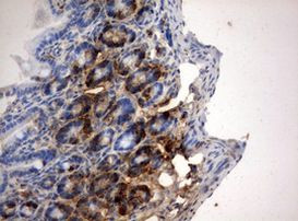 BrdU Antibody in Immunohistochemistry (Paraffin) (IHC (P))