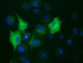 BuB1B Antibody in Immunocytochemistry (ICC/IF)