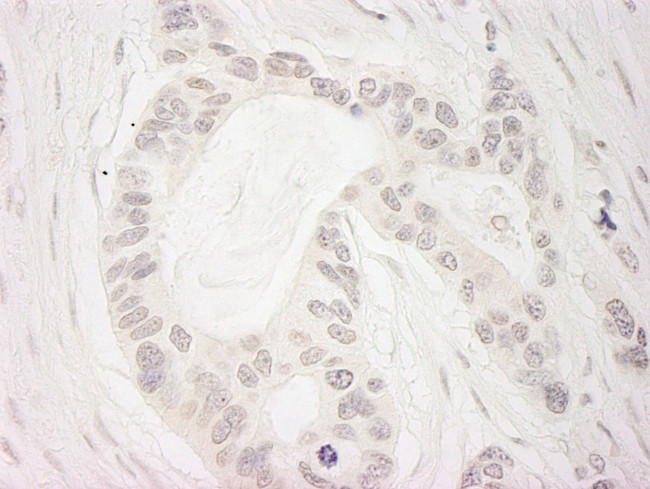 BubR1 Antibody in Immunohistochemistry (IHC)