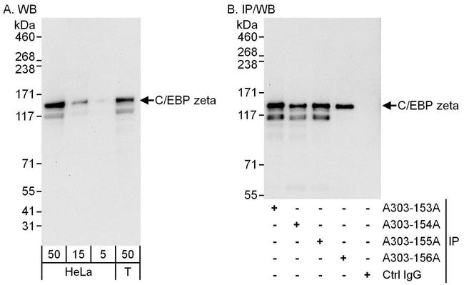 C/EBP zeta Antibody in Western Blot (WB)