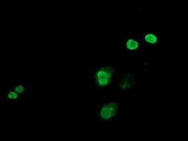 C-Jun Antibody in Immunocytochemistry (ICC/IF)