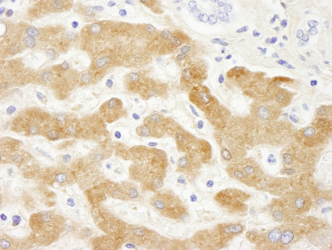 Human C-Reactive Protein (CRP) Antibody in Immunohistochemistry (IHC)