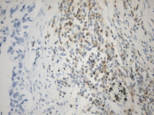 C10orf54 Antibody in Immunohistochemistry (Paraffin) (IHC (P))