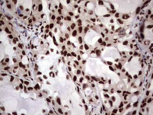 C14orf166 Antibody in Immunohistochemistry (Paraffin) (IHC (P))