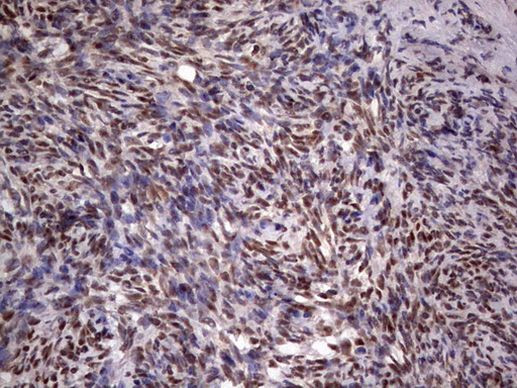 C14orf166 Antibody in Immunohistochemistry (Paraffin) (IHC (P))