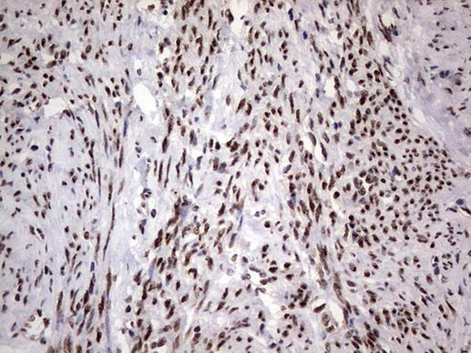 C14orf166 Antibody in Immunohistochemistry (Paraffin) (IHC (P))