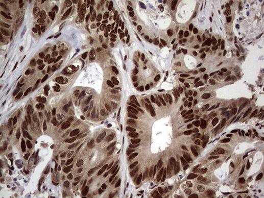 C14orf166 Antibody in Immunohistochemistry (Paraffin) (IHC (P))