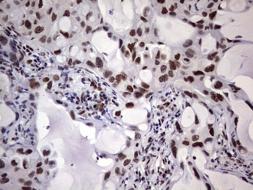 RTRAF Antibody in Immunohistochemistry (Paraffin) (IHC (P))