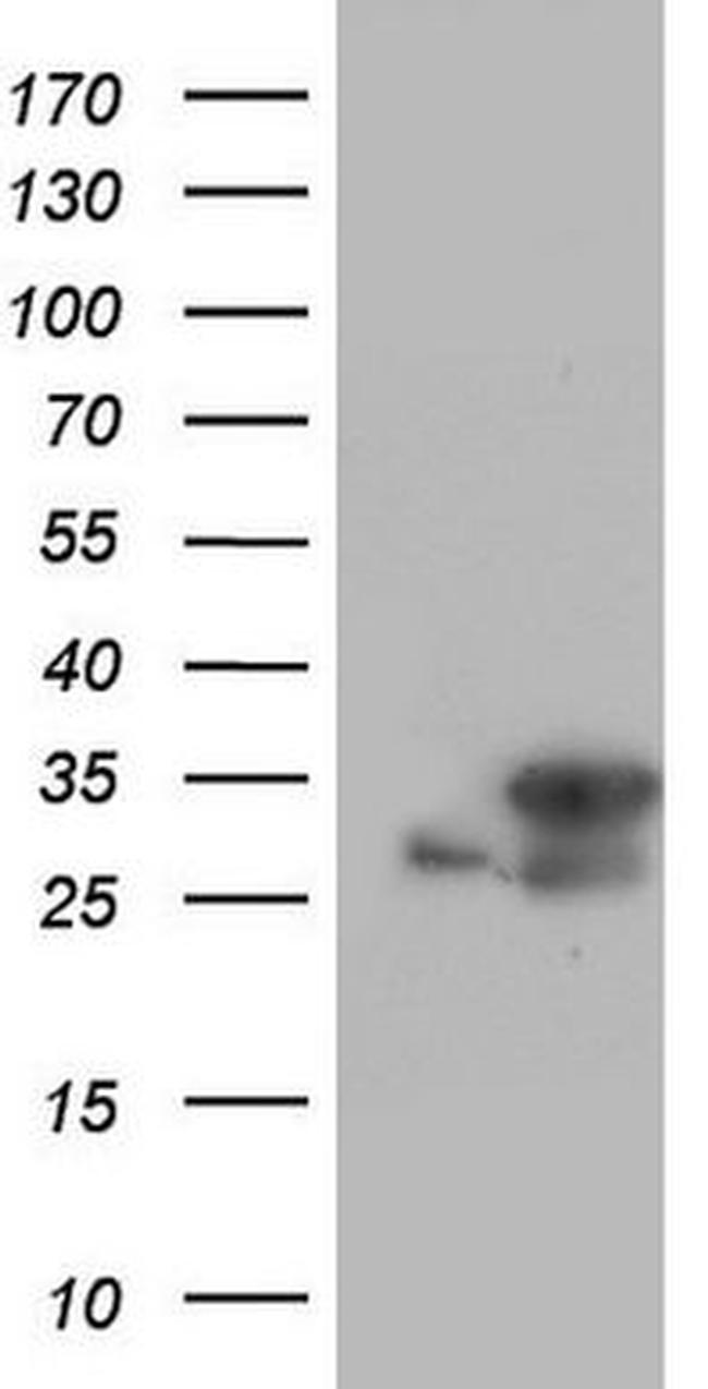 C14orf166 Antibody in Western Blot (WB)