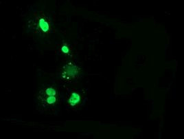 C16orf72 Antibody in Immunocytochemistry (ICC/IF)