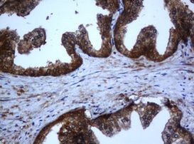 C1S Antibody in Immunohistochemistry (Paraffin) (IHC (P))