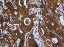 C1S Antibody in Immunohistochemistry (Paraffin) (IHC (P))