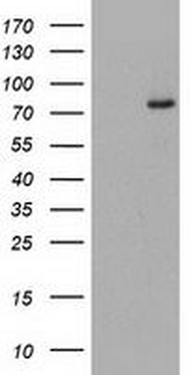 C1S Antibody in Western Blot (WB)