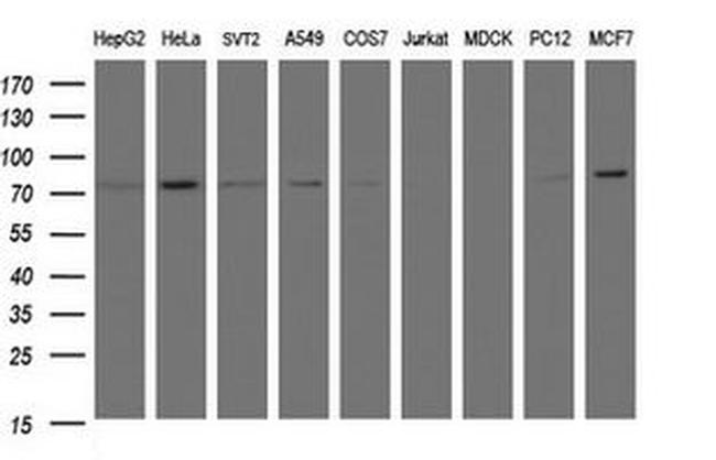 C1S Antibody in Western Blot (WB)