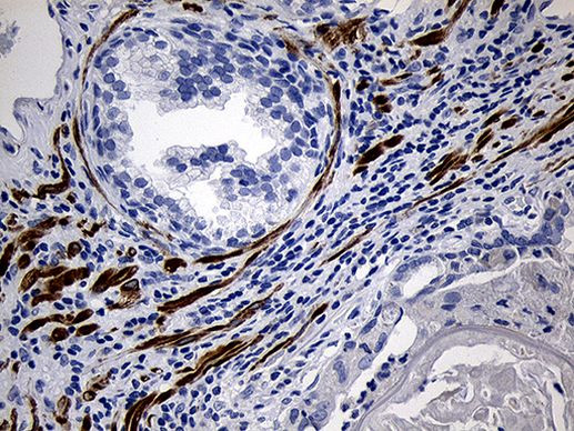 C1orf111 Antibody in Immunohistochemistry (Paraffin) (IHC (P))