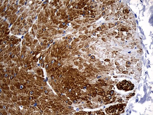 C1orf111 Antibody in Immunohistochemistry (Paraffin) (IHC (P))