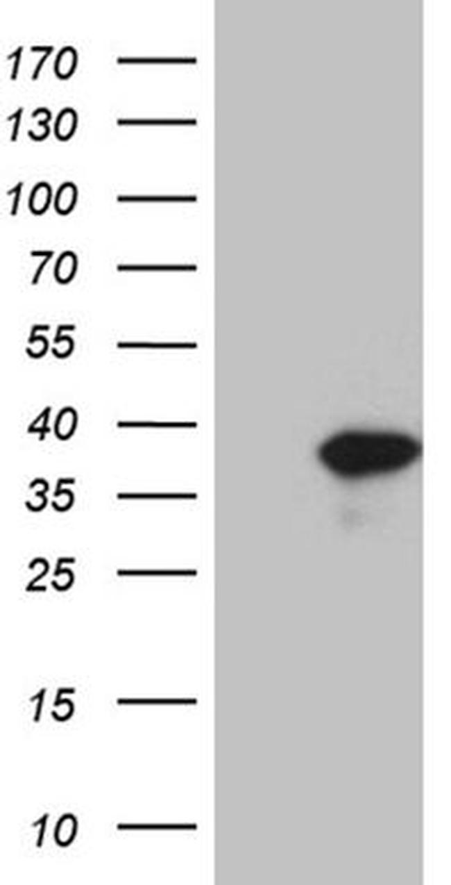 C1orf111 Antibody in Western Blot (WB)