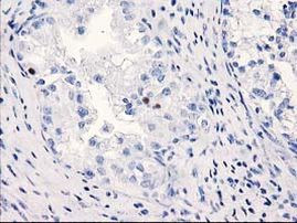 C1orf50 Antibody in Immunohistochemistry (Paraffin) (IHC (P))