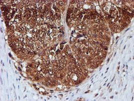 C1orf50 Antibody in Immunohistochemistry (Paraffin) (IHC (P))