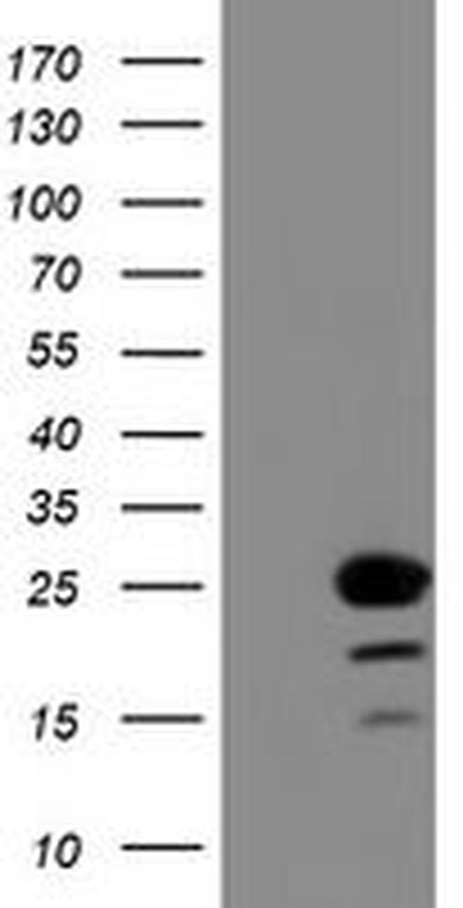 C1orf50 Antibody in Western Blot (WB)