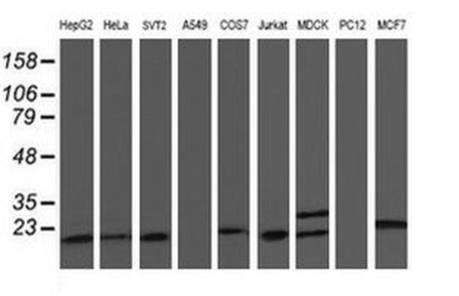 C1orf50 Antibody in Western Blot (WB)