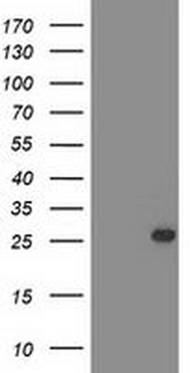 C1orf50 Antibody in Western Blot (WB)