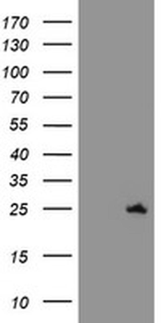 C21orf56 Antibody in Western Blot (WB)