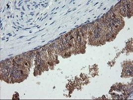 C2orf62 Antibody in Immunohistochemistry (Paraffin) (IHC (P))