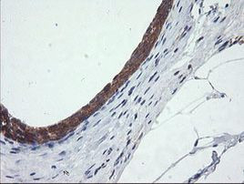 C2orf62 Antibody in Immunohistochemistry (Paraffin) (IHC (P))