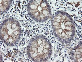 C2orf62 Antibody in Immunohistochemistry (Paraffin) (IHC (P))