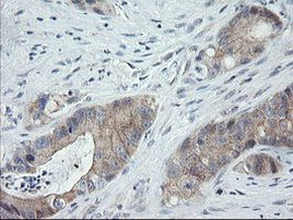 C2orf62 Antibody in Immunohistochemistry (Paraffin) (IHC (P))