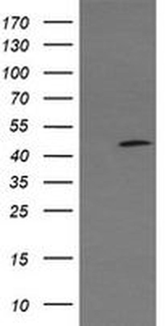 C2orf62 Antibody in Western Blot (WB)