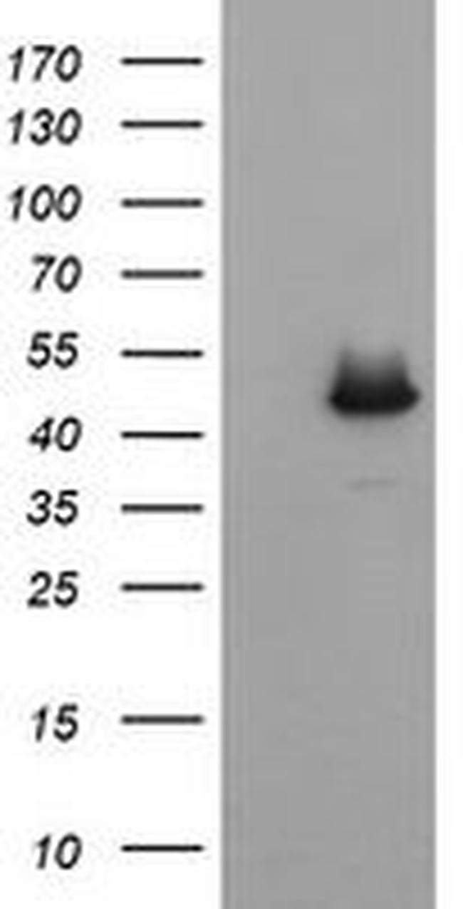 C2orf62 Antibody in Western Blot (WB)