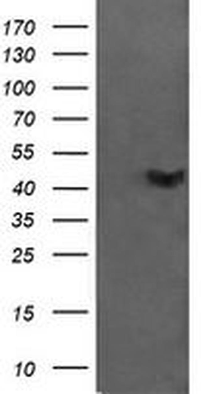 C2orf62 Antibody in Western Blot (WB)