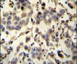 C6orf58 Antibody in Immunohistochemistry (IHC)