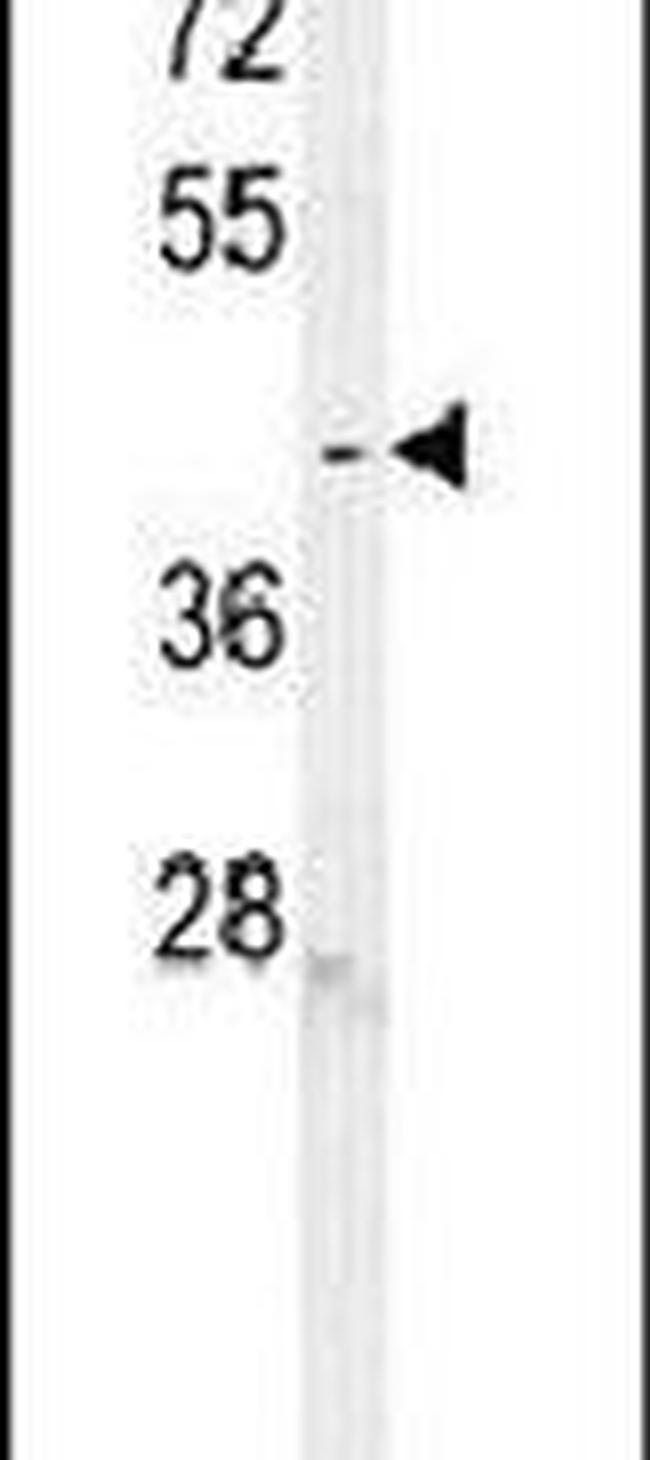 C6orf58 Antibody in Western Blot (WB)