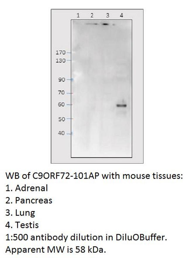 C9orf72 Antibody in Western Blot (WB)