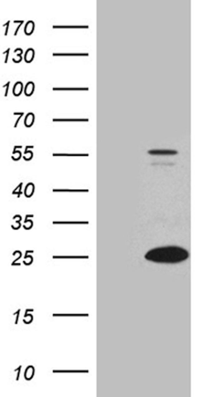 C9orf89 Antibody in Western Blot (WB)