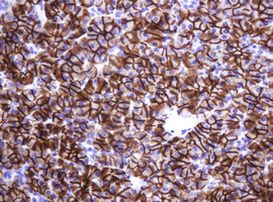 CA12 Antibody in Immunohistochemistry (Paraffin) (IHC (P))