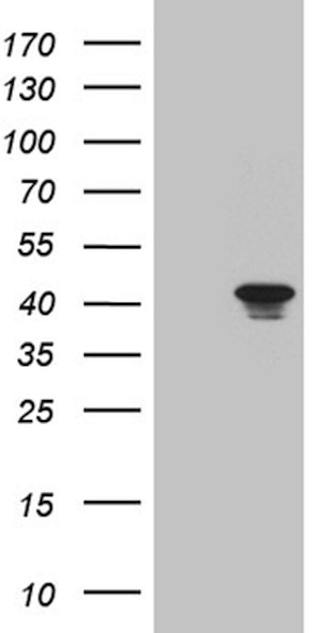 CABLES1 Antibody in Western Blot (WB)