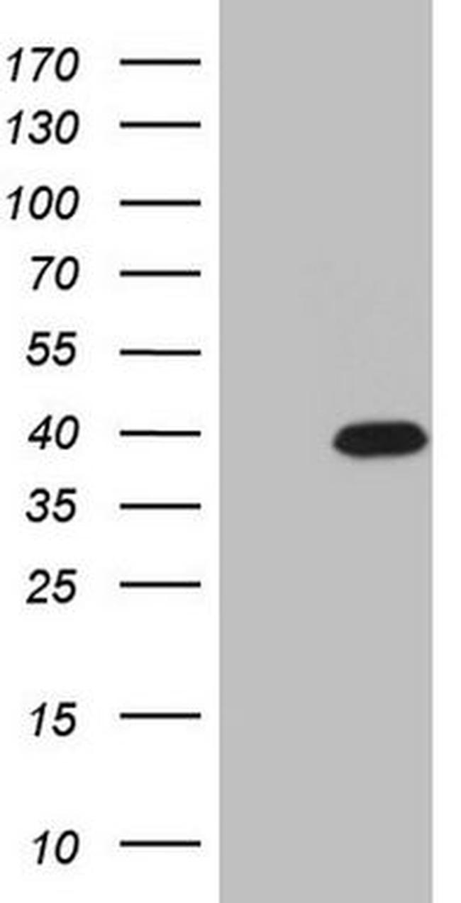 CABP4 Antibody in Western Blot (WB)