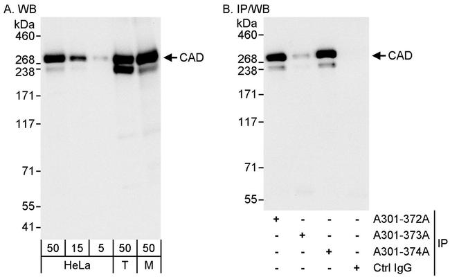 CAD Antibody in Western Blot (WB)