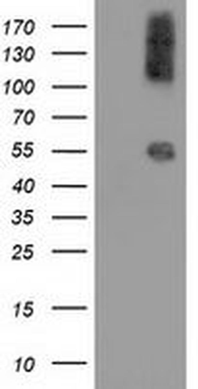 CALCOCO2 Antibody in Western Blot (WB)