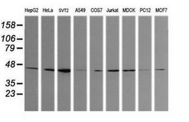 CALR3 Antibody in Western Blot (WB)