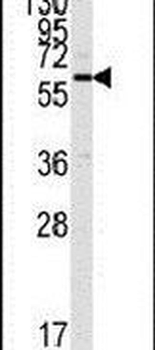 CaMKII alpha Antibody in Western Blot (WB)