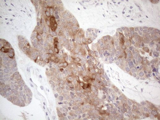 CAMK2B Antibody in Immunohistochemistry (Paraffin) (IHC (P))